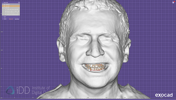face_scanner_review_dentistry_iDD20