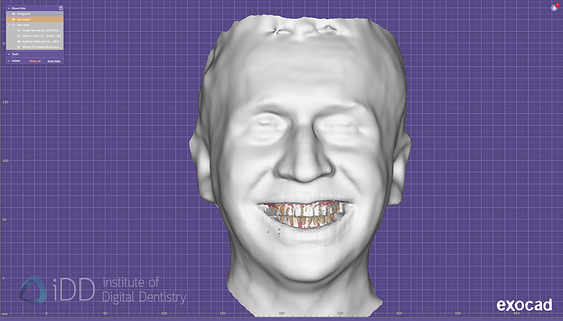 face_scanner_review_dentistry_iDD22