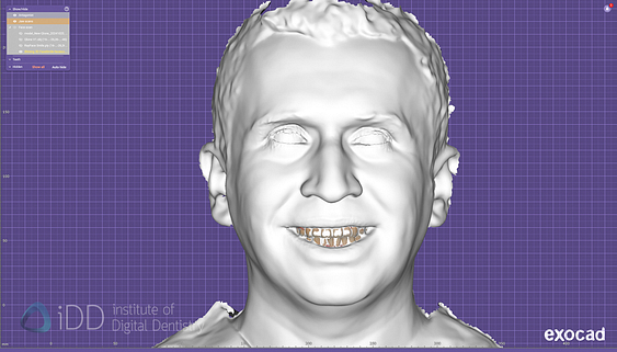 face_scanner_review_dentistry_iDD24