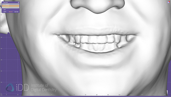 face_scanner_review_dentistry_iDD27