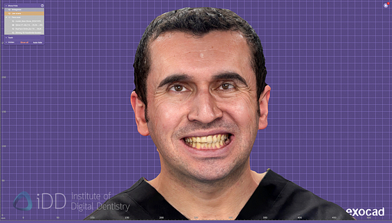 face_scanner_review_dentistry_iDD3