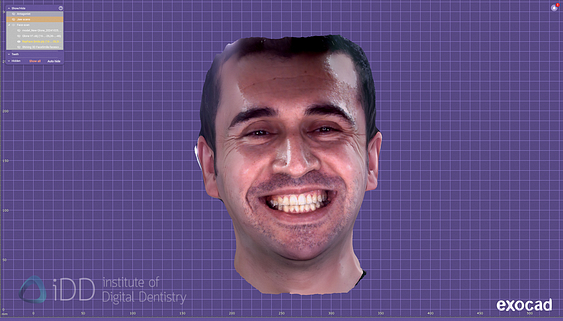 face_scanner_review_dentistry_iDD4