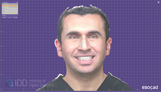 face_scanner_review_dentistry_iDD5