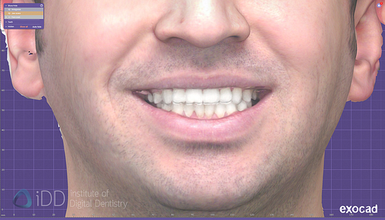 face_scanner_review_dentistry_iDD6