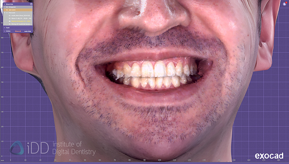 face_scanner_review_dentistry_iDD7