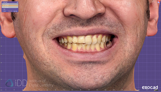 face_scanner_review_dentistry_iDD8