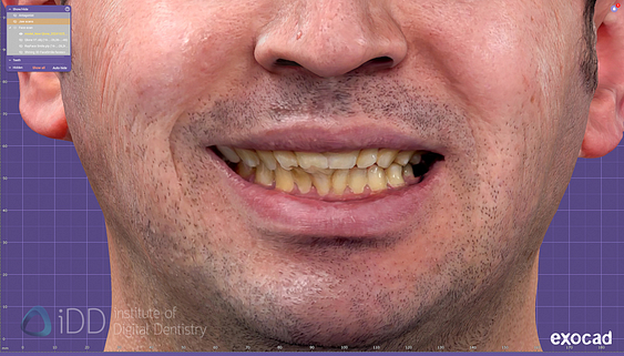 face_scanner_review_dentistry_iDD9