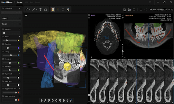 RAY 5D Enhanced patient communication
