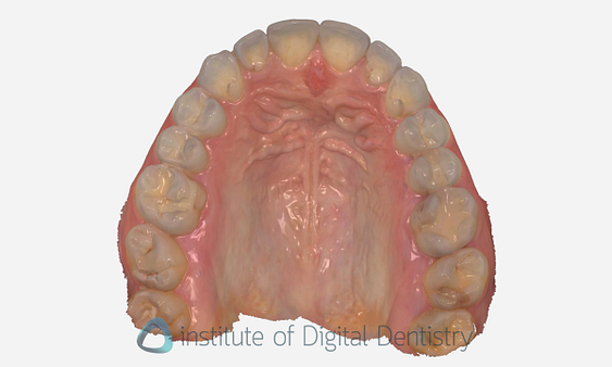 3shape_software_dental_studio_idd_review39