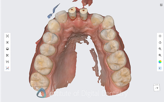 medit_i900_Classic_software_review7