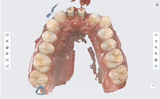 medit_i900_Classic_software_review11