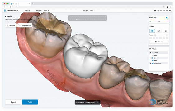 imagoworks-dentbird-ai-crown-design-web-dental-cad-3dme-idd-institute-of-digital-dentistry-podcast-blog