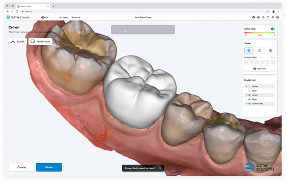 imagoworks-dentbird-ai-crown-design-web-dental-cad-3dme-idd-institute-of-digital-dentistry-podcast-blog