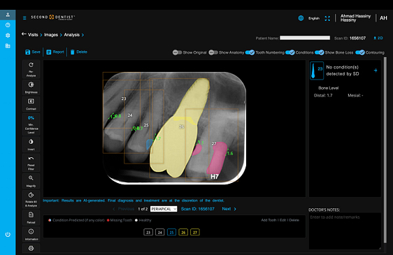 velmeni-second-dentist-ai-review-blog-idd-institute-of-digital-dentistry-software-patient-image-analysis-periapical