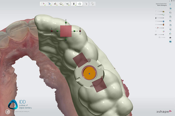 idd-3d-printed-surgical-guides-workflow-design-3shape-implant-studio