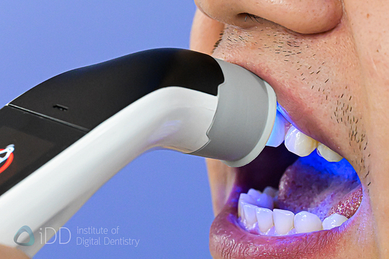 borea_cobra_shade_matching_dentistry_Dental Spectrophotometers and Shade-Matching_iDD16