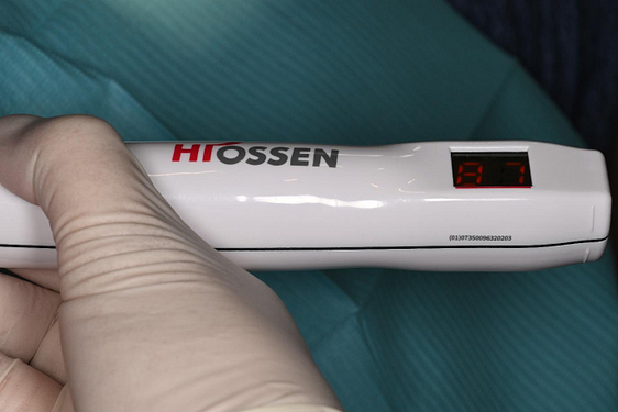 Hiossen IS3 ISQ Monitor