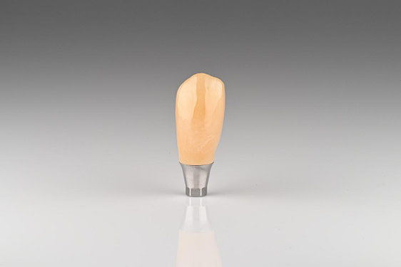 Crown is milled, sintered, stained, glazed, and cemented to the Ti base 2