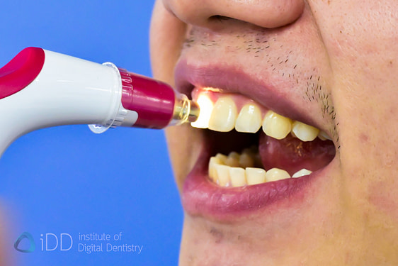 borea_cobra_shade_matching_dentistry_Dental Spectrophotometers and Shade-Matching_iDD11