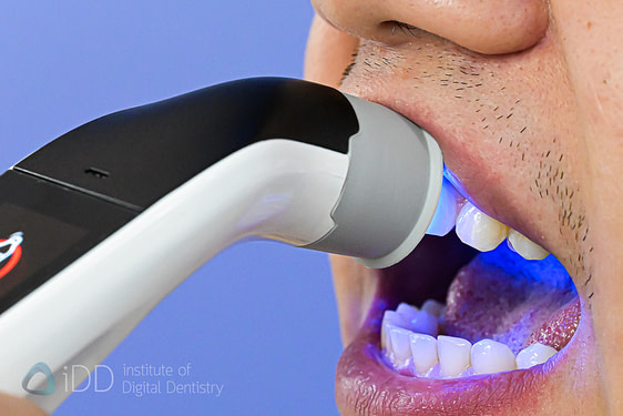 borea_cobra_shade_matching_dentistry_Dental Spectrophotometers and Shade-Matching_iDD16