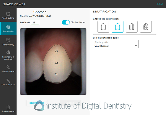borea_cobra_dental_shade_matching2