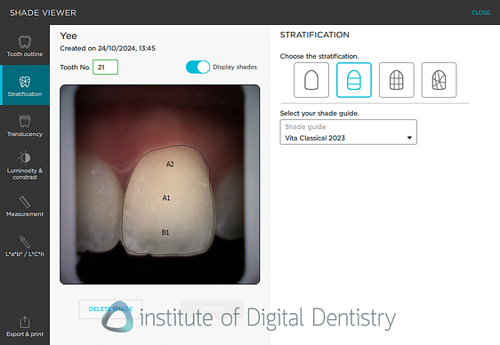 borea_cobra_smart_shade_digital_dentistry_iDD3