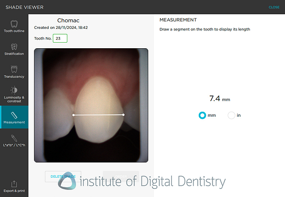 borea_cobra_dental_shade_matching5