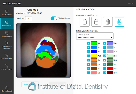 shade_matching_software_dental-iDD2