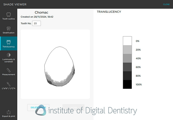shade_matching_software_dental-iDD1