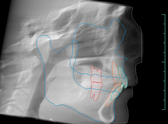 Diagnocat Review - AI Diagnostics of 2D and 3D X-rays in Dentistry