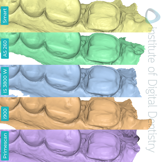 panda-smart-alliedstar-as260-dexis-is-3800-w-medit-i900-cerec-primescan-dentsply-sirona-idd-compares-institute-of-digital-dentistry-blog-medit-software-app-prep-margin-line-lingual-view