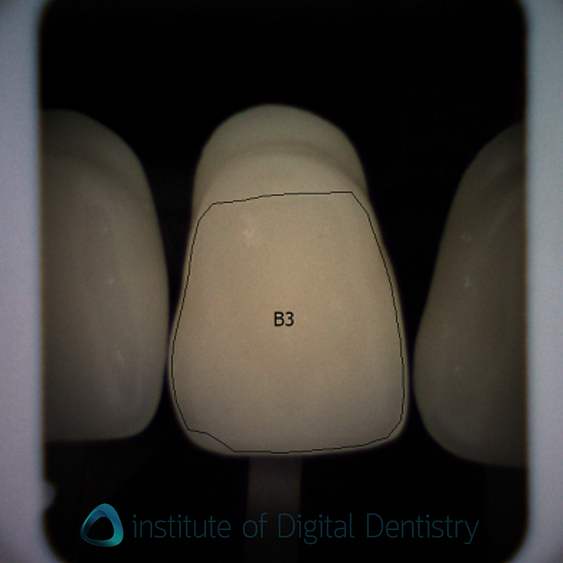 shade_guide_test_borea3