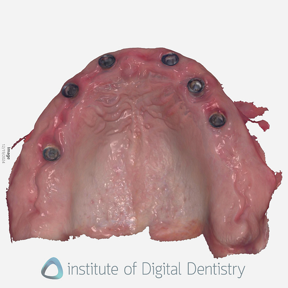 3shape_software_dental_studio_idd_review38