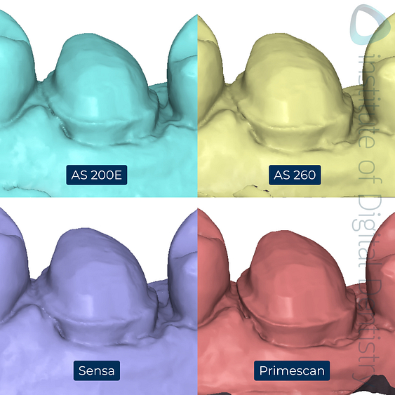 6-Alliedstar-AS260-AS200E-Sensa-Dentsply-Sirona-Primescan-intraoral-scanner-ios-idd-compares-upper-margin-prep-buccal