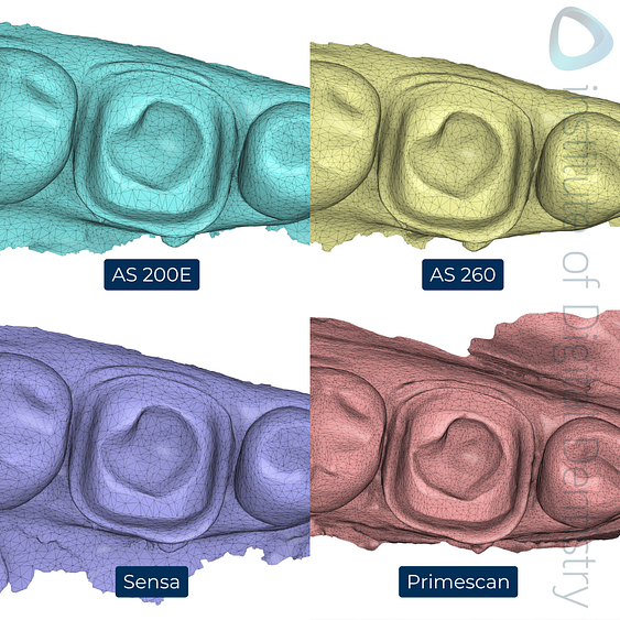 7-Alliedstar-AS260-AS200E-Sensa-Dentsply-Sirona-Primescan-intraoral-scanner-ios-idd-compares-lower-density-mesh-tessellation