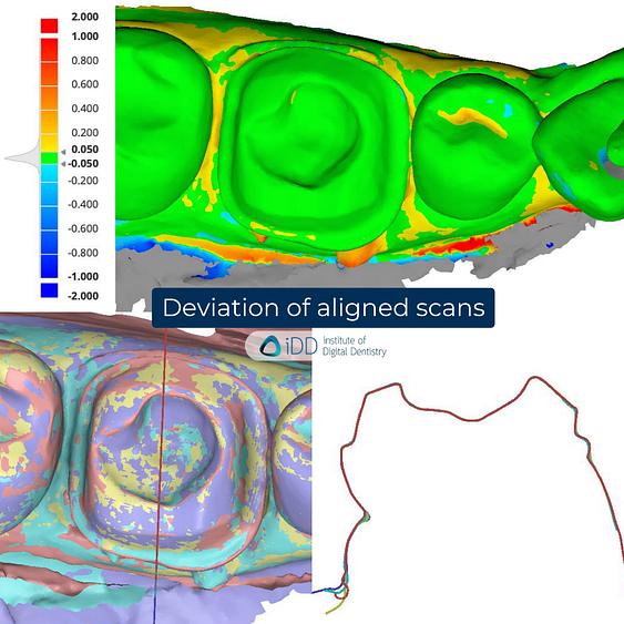 8-Alliedstar-AS260-AS200E-Sensa-Dentsply-Sirona-Primescan-intraoral-scanner-ios-idd-compares-lower-deviation-alignment-accuracy