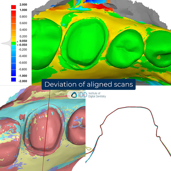 9-Alliedstar-AS260-AS200E-Sensa-Dentsply-Sirona-Primescan-intraoral-scanner-ios-idd-compares-upper-deviation-alignment-accuracy