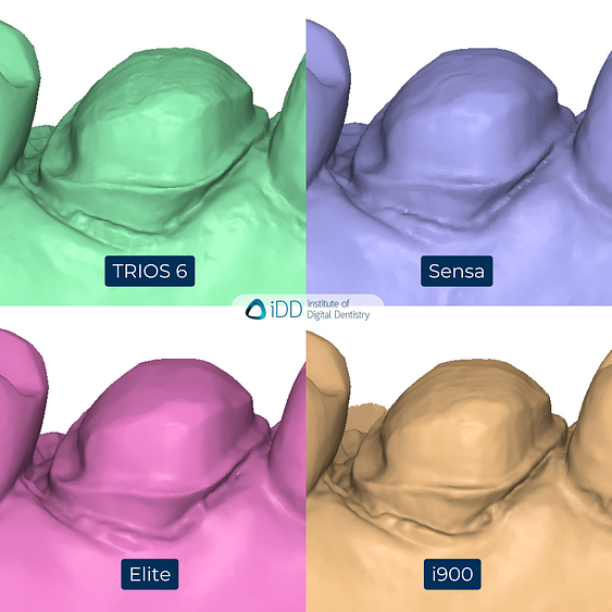 6-3Shape-TRIOS-6-Alliedstar-Sensa-Shining-3D-Aoralscan-Elite-Medit-i900-intraoral-scanner-ios-idd-compares-upper-stl-scan-palatal-margin-prep-view