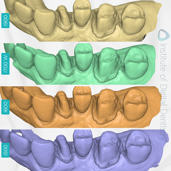 medit-intraoral-scanner-i500-i600-i700-wireless-i900-idd-compares-institute-of-digital-dentistry-blog-prep-margin-line-buccal-view