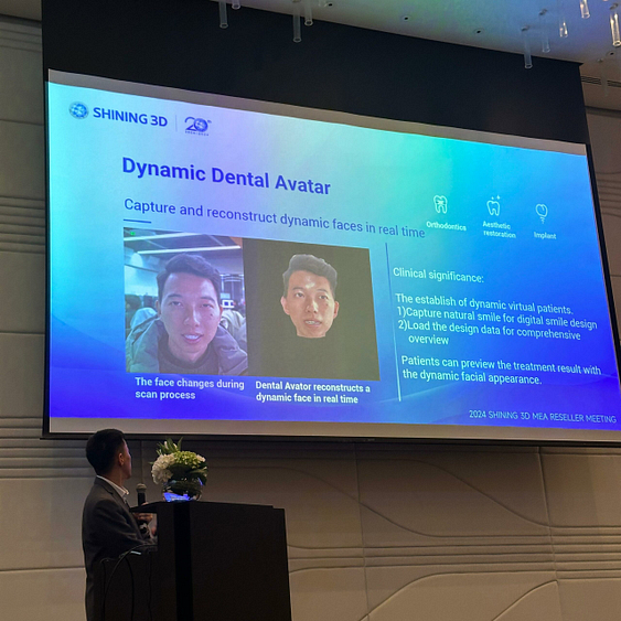 Shining 3D MEA event new intraoral scanner elite 1 (4)