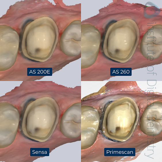 2-Alliedstar-AS260-AS200E-Sensa-Dentsply-Sirona-Primescan-intraoral-scanner-ios-idd-compares-upper-native-color