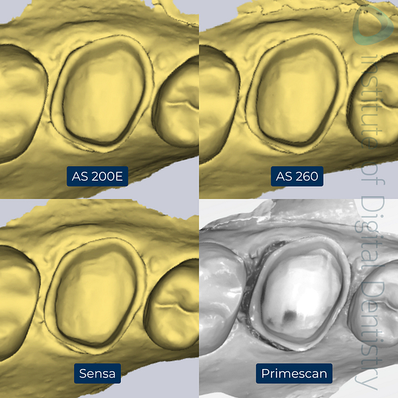 3-Alliedstar-AS260-AS200E-Sensa-Dentsply-Sirona-Primescan-intraoral-scanner-ios-idd-compares-upper-native-monochrome