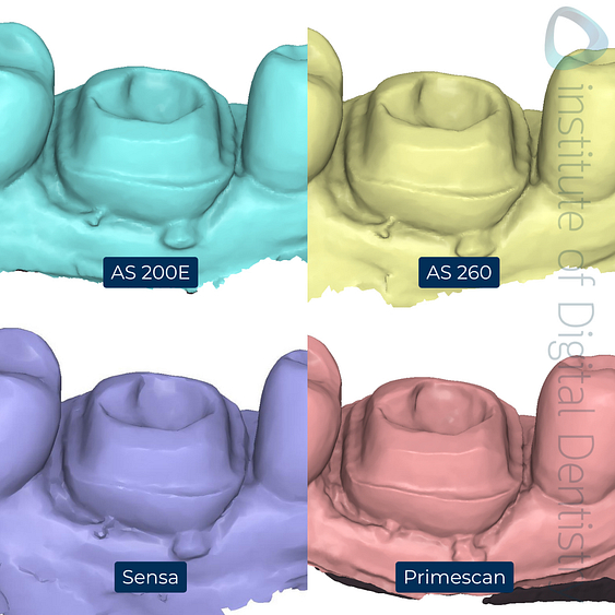 5-Alliedstar-AS260-AS200E-Sensa-Dentsply-Sirona-Primescan-intraoral-scanner-ios-idd-compares-lower-margin-prep-buccal