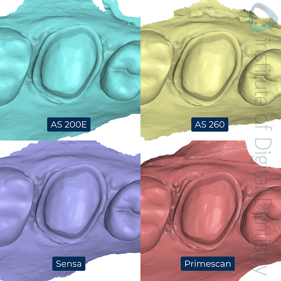 5-Alliedstar-AS260-AS200E-Sensa-Dentsply-Sirona-Primescan-intraoral-scanner-ios-idd-compares-upper-stl-scan