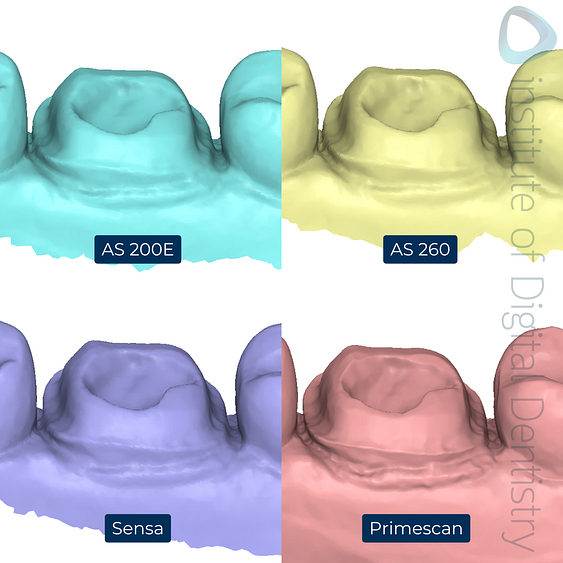 6-Alliedstar-AS260-AS200E-Sensa-Dentsply-Sirona-Primescan-intraoral-scanner-ios-idd-compares-lower-margin-prep-lingual
