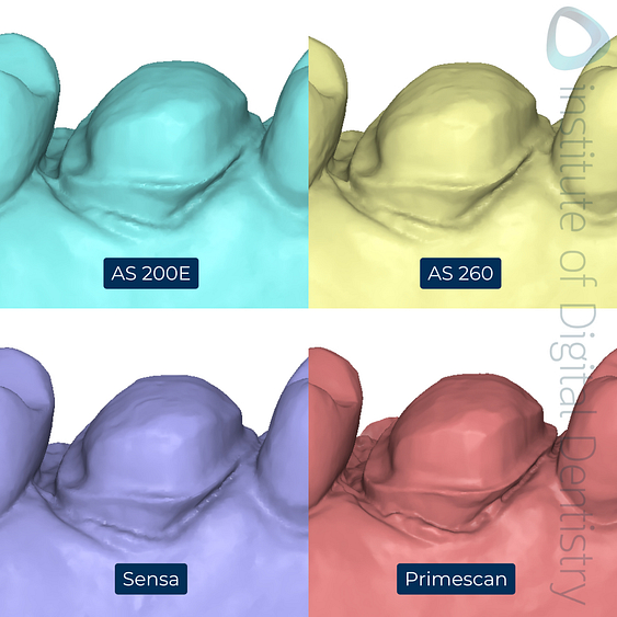 7-Alliedstar-AS260-AS200E-Sensa-Dentsply-Sirona-Primescan-intraoral-scanner-ios-idd-compares-upper-margin-prep-palatal