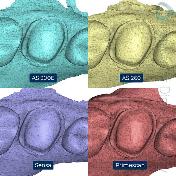 8-Alliedstar-AS260-AS200E-Sensa-Dentsply-Sirona-Primescan-intraoral-scanner-ios-idd-compares-upper-density-mesh-tessellation