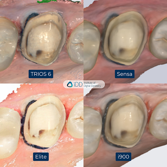 2-3Shape-TRIOS-6-Alliedstar-Sensa-Shining-3D-Aoralscan-Elite-Medit-i900-intraoral-scanner-ios-idd-compares-upper-native-scan-color