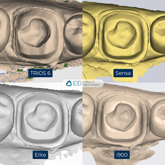 3-3Shape-TRIOS-6-Alliedstar-Sensa-Shining-3D-Aoralscan-Elite-Medit-i900-intraoral-scanner-ios-idd-compares-lower-native-scan-monochrome