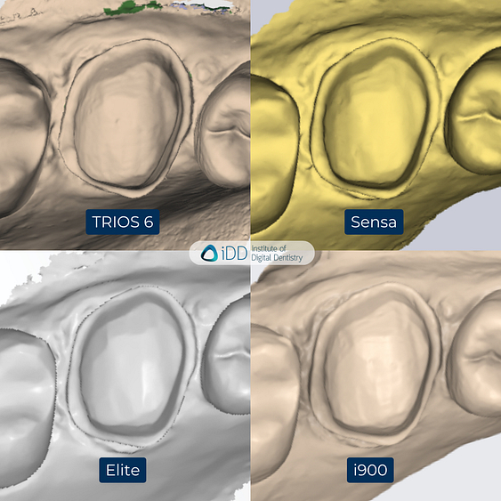 3-3Shape-TRIOS-6-Alliedstar-Sensa-Shining-3D-Aoralscan-Elite-Medit-i900-intraoral-scanner-ios-idd-compares-upper-native-scan-monochrome